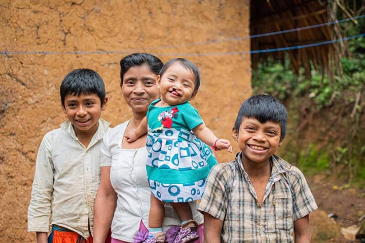 Mãe sorrindo com os filhos e a filha afetada nascida com fissura labiopalatina antes da cirurgia