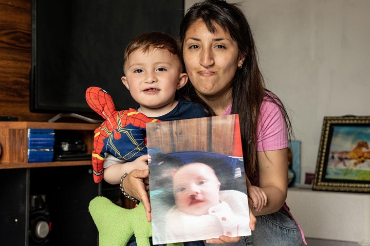 Edden, smiling, holding a picture of himself before cleft surgery